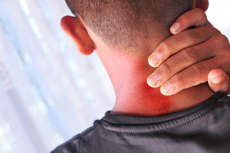 A man's hand on his neck showing redness and irritation.